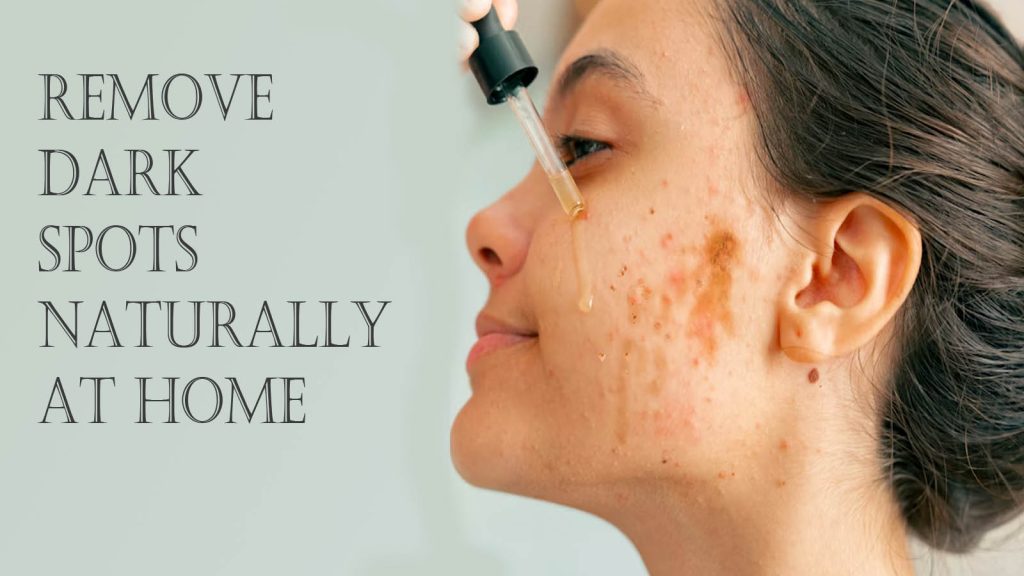 Remove Dark Spots Naturally at Home